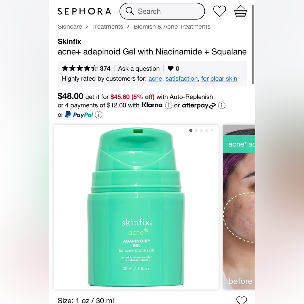 SkinFix adapinoid gel